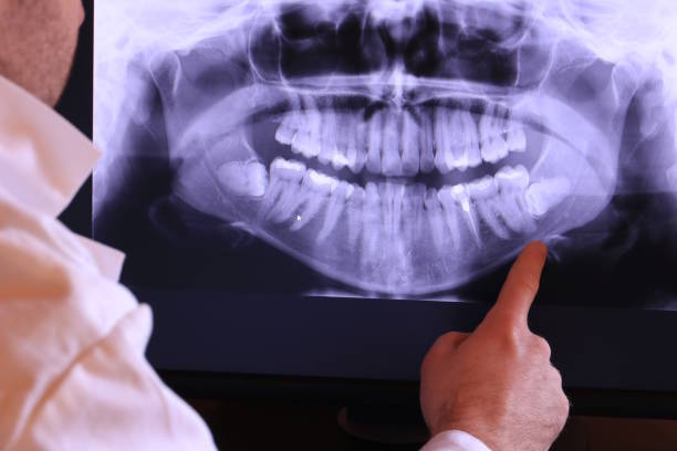 Professional Emergency Dentist in MT